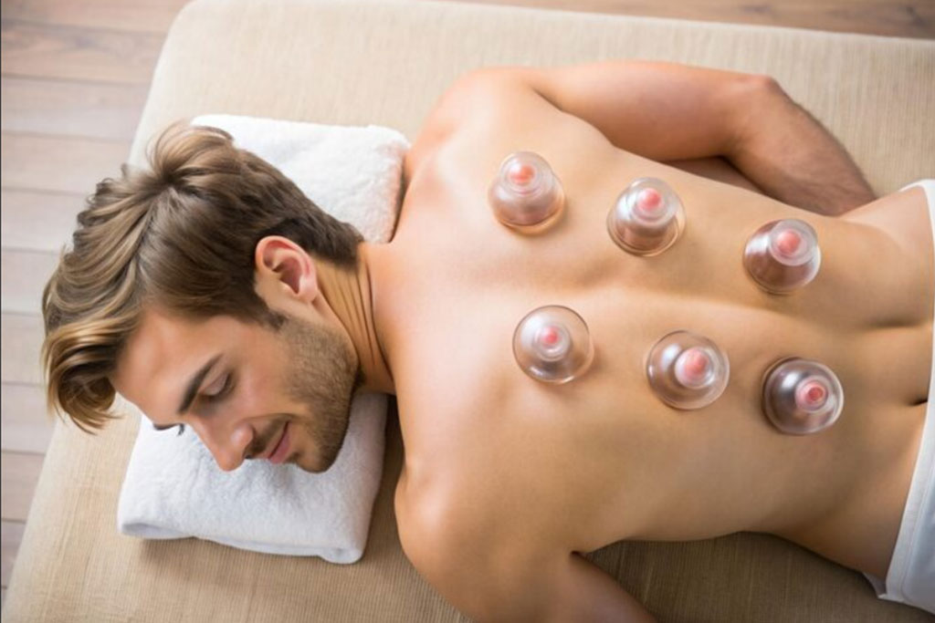 Benefits Of Cupping